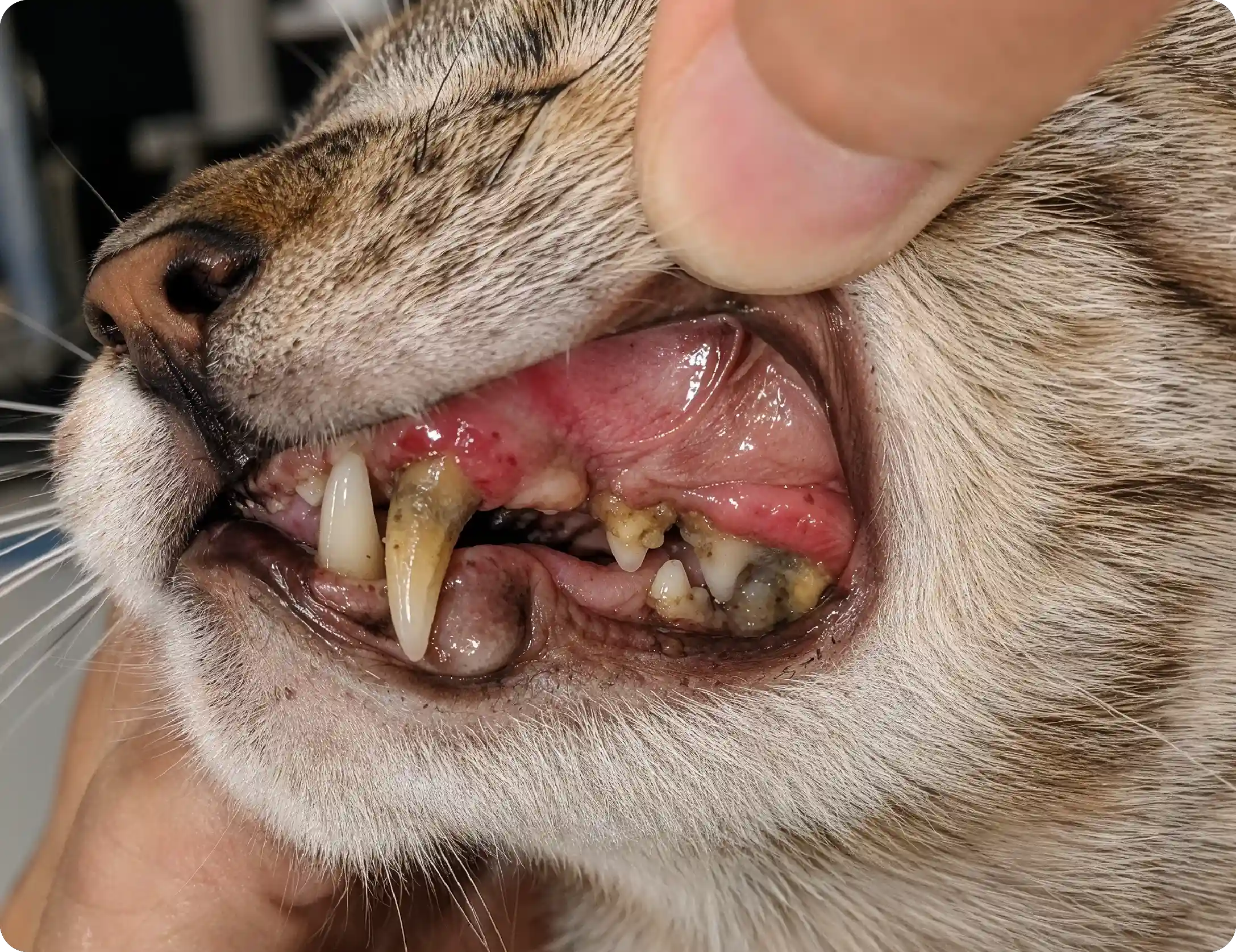 Periodontal Disease